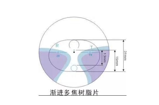 美麗島多焦鏡適合的人群，需要注意的事項